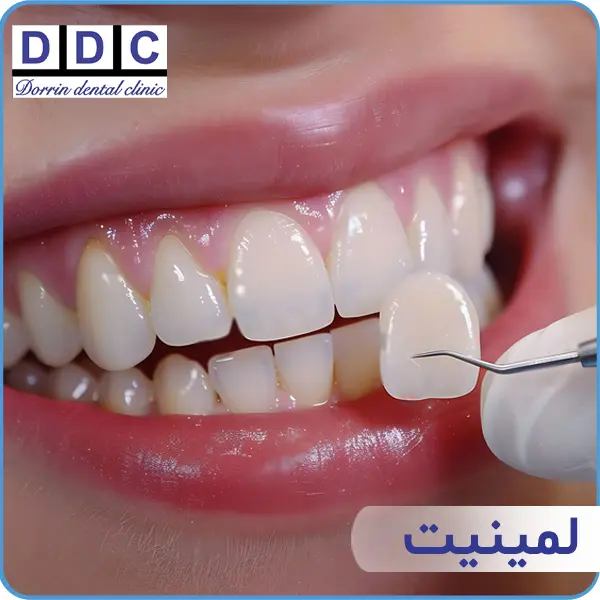 لمینیت